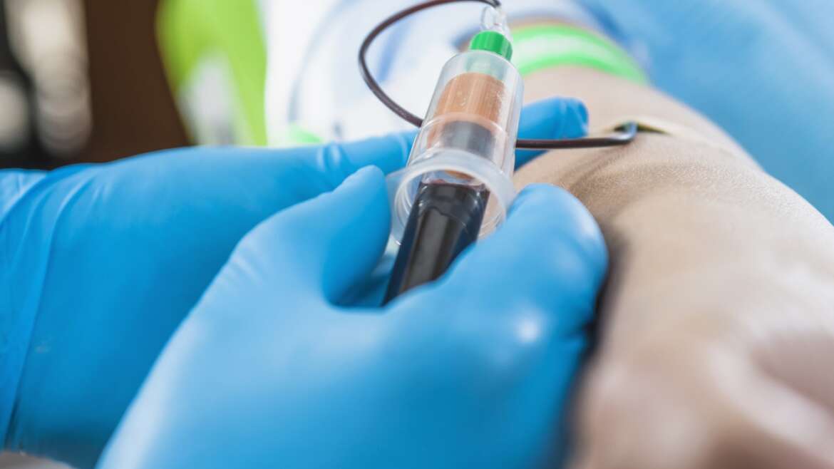 Stem Cell Harvesting